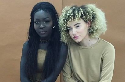 Kerap Dibully Karena Warna Kulit Beda, 9 Orang Ini Kini Sukses Jadi Model Terkenal