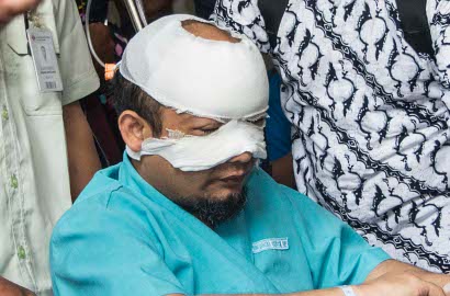 Sudah Selesai, Apa Alasan Polri Belum Sebar Sketsa Penyerang Novel Baswedan?