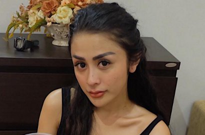 Sukses Filler Bibir, Pedangdut Selvi Kitty Dipuji Makin Cantik