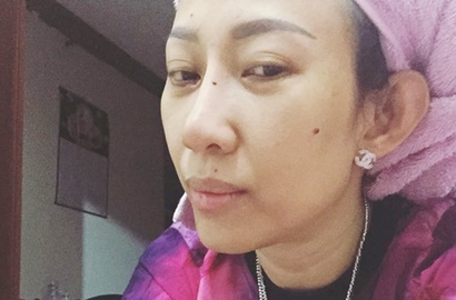 Akhirnya Kapok, Ini Alasan Dewi Sanca Operasi Plastik Kantong Mata