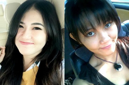 Foto Jadul Kelihatan Beda, Via Vallen Bela Diri Dituduh Operasi Plastik
