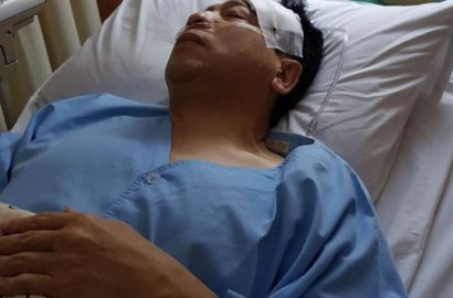 Pemeriksaan Cedera Kepala Ditunda, Setya Novanto Pindah ke RSCM Kencana