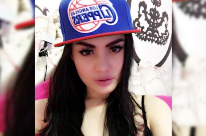 Jennifer Dunn Pamer Ferrari Merah Dibully 'Pelakor Kelas Kakap', Foto 'Operasi Plastik' Beredar