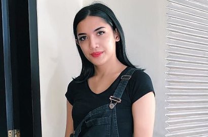 Millendaru Pede Pamer Foto Usai Kerokan, Netter Ramai Beri Komentar Kocak