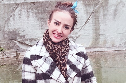 Alami Kekerasan, Cynthiara Alona Ungkap Penyebab Lebam di Wajahnya