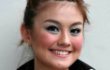 Mungkinkah Cedera Punggung Agnes Monica Cukup Parah?