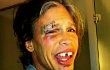 Foto Steven Tyler Seusai Kecelakaan di Paraguay