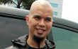 Ahmad Dhani Pincang Karena Asam Urat