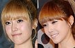 Jessica SNSD Diduga Lakukan Operasi Plastik Rahang