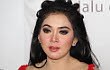 Kaki Syahrini Diperban Gara-Gara Penonton