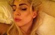 Pajang Foto di Twitter, Lady GaGa Diduga Operasi Plastik