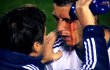 Cristiano Ronaldo Cetak Gol Walau Mata Berdarah