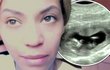 Beyonce Knowles Ungkap Foto Sonogram Blue Ivy