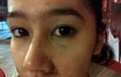 Ardina Rasti Bohong Soal Foto Wajah Lebamnya