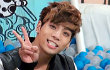 Jonghyun SHINee Sukses Jalani Operasi Hidung Akibat Kecelakaan