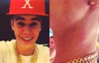 Leher Justin Bieber Terluka Gara-Gara Jatuh dari Tangga