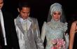 Pakai Sepatu 12 Sentimeter di Resepsi Pernikahan, Kaki Alyssa Soebandono Pegal